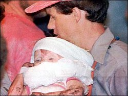 A 1987 file photo of 18-month-old Jessica McClure after being rescued from a well in Midland, Texas.